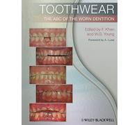 Toothwear: The ABC of the Worn Dentition – Wiley-VCH