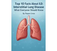 Top 10 Facts About ILD: Interstitial Lung Disease What Everyone Should Know (Medical Facts by Zentara UK)