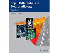 Top 3 Differentials in Neuroradiology: A Case Review