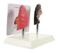 TOPPERFUN Realistic Comparison for Model Anatomy Pvc and Teaching Physiology Lung Normal Educational Smoking Human for Study