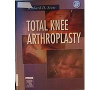 Total Knee Arthroplasty