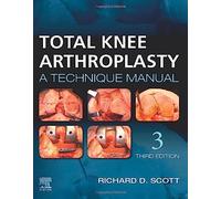Total Knee Arthroplasty: A Technique Manual