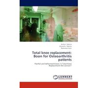 Total knee replacement: Boon for Osteoarthritis patients: Painful and deformed knees: Is Total Knee Replacement the answer?