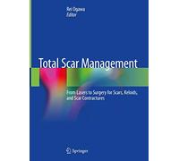 Total Scar Management: From Lasers to Surgery for Scars, Keloids, and Scar Contractures