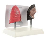 TOYANDONA Anatomy Model Human Lung Comparison for Educational Use in Smoking Teaching Scenarios with PVC Material