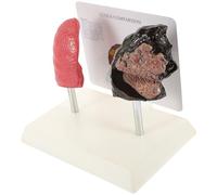 Toyvian Lung Anatomy Model 2pcs Set Human Lungs Model Pathological Pulmonary Demonstration for Anatomy and Physiology Teaching