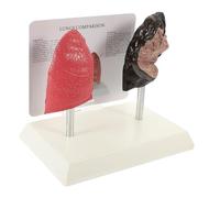 TOYZFRIENDY Smoking Lung Comparison Model with Healthy and Pathological Lungs Realistic Respiratory Anatomy Teaching Tool for Medical Students Home Lab and Nursing Education