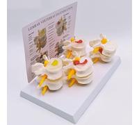 TQPGJJL 4-Stage Lumbar Spine Model - Human Spine Anatomical Model, 27×16×10cm | Teaching Aid for Medical School, Patient Education & Student Study | Premium PVC with Display Stand