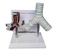 Trachea Model - Comparative Smoking Trachea And Normal Tracheai Anatomy Medical Study Model - Human Organ Anatomical Model Visceral Trachea Model - for Study Teaching