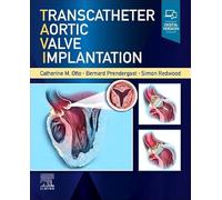 Transcatheter Aortic Valve Implantation