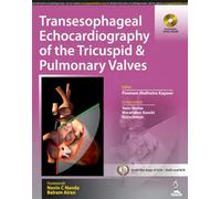 Transesophageal Echocardiography of the Tricuspid and Pulmonary Valves