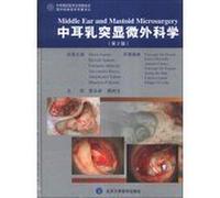 Translations of foreign classic medical classics : middle ear microsurgery ( 2nd Edition )(Chinese Edition)