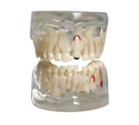 Transparent Children's Dental Model Deciduous Tooth Demonstration for Teaching Primary Teeth Anatomy