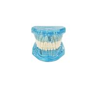 Transparent Disease Teeth Model, YOUYA DENTAL Transparent Dental Implant Teeth Model Dentist Standard Disease Removable Tooth Pathological Teaching Model(Blue)