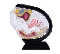 Transparent Uterus Model, Female Reproductive Organ Model, Visible Uterine Structure Anatomy Model, for Gynecology Medical Educational Training.(Black)