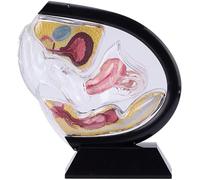 Transparent Uterus Model, Include Pelvic Cavity Abdominal Bladder Ovary Rectum Coccyx Human Uterine Structure Anatomical Model for Teaching & Educational Learning(Black)