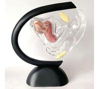 Transparent Uterus Model Pathological Uterus Reproductive System Model Medical Teaching Aids Human Uterus Anatomy Model