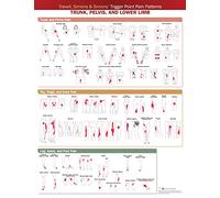 Travell, Simons & Simons’ Trigger Point Pain Patterns Wall Chart: Trunk, Pelvis, and Lower Limb