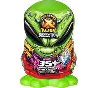 Treasure X Mega Alien Dissection Playset Toy for Kids