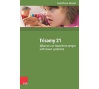 Trisomy 21: What We Can Learn from People with Down Syndrome