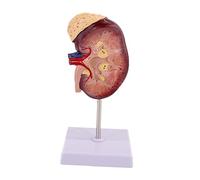 TTETTZ Human Kidney Model Tool, 2x Actual Size with Base, Dissection Model, Learning Class Accessory.