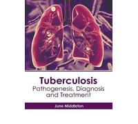 Tuberculosis: Pathogenesis, Diagnosis and Treatment
