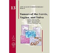 Tumors of the Cervix, Vagina, and Vulva: No. 13 (AFIP Atlas of Tumor Pathology, Series 4,)