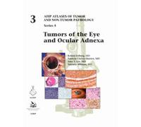 Tumors of the Eye and Ocular Adnexa