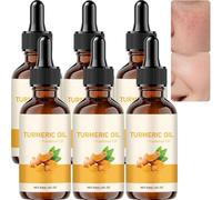 Turmeric Oil for Face & Body, Dark Spot Corrector Serum for Brightening Even Skin Tone, Anti-Aging Facial Essential Oil with Vitamin E, Moisturizer Glow Serum Improves Rough Dry Skin (6Pcs)