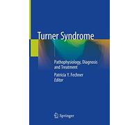Turner Syndrome: Pathophysiology, Diagnosis and Treatment