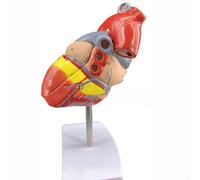 Two Part Human Heart Model for For classroom and Research Use Featuring Anatomical Accuracy of Atria, Ventricles, Valves, and Blood Vessels Mounted on Plastic Stand