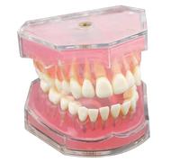 Typodont Teeth Model with Removable Teeth Dental Model Study Teaching Dental Mode