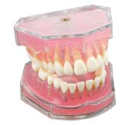 Typodont Teeth Model with Removable Teeth, Dental Model Study Teaching Tool for Students, Dentist Office Display, Learning Educational Dental Mode