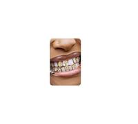 UBGICIG 6Pcs Dental Grillz, Gold Plated Tooth Cap Fake Grill, Diamond Grillz Teeth for Men Women, Vampire Faux Halloween Top Teeth Kit, Hip Hop Jewelry with Molding Bars