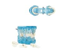 UIGJIOG Dental Teaching Mould Dental Anatomy Model Transparent Dental Model Dental Disease Teeth Transparent Dental Model Dental Model Dentist Standard Disease Removable Pathology Teaching Model