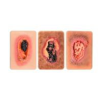 UIGJIOG Skin Wound Model Simulation Model for Skin Healing Silicone Dressing Simulation Device by Granulation (3 or 4 Pieces) Palm-Sized Dressing Model