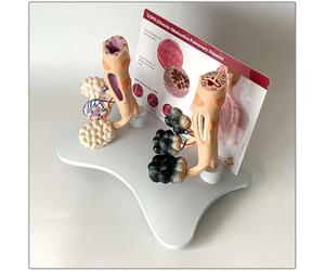 UIGJIOG Smokers Lung Model Healthy Lung Model Human Smoking Lung Health Alveolar Model with Pathological Features And Accurate Anatomy Structure for The Effects of Smoking on Lung Health