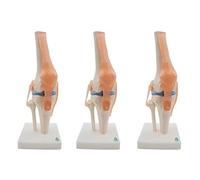 Uikdjgu 3X Anatomical Knee Joint with Ligaments Model, Life Size