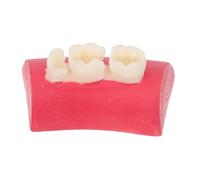 ULTECHNOVO Dental Practice Model Anatomy Model Plastic Training Tooth for Obturation Canal Shaping, Independent Practice, Rct Training Aid for Student Dentists