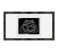 'Ultrasound Baby Photo' Pet Feeding Mat (PM00029101)