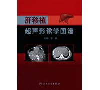 Ultrasound Imaging Atlas of liver transplantation(Chinese Edition)