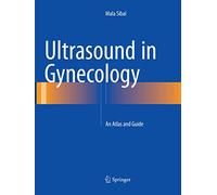 Ultrasound in Gynecology: An Atlas and Guide – Springer Verlag