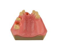 Ultrassist Dental Implant Training Practice Maxillary Model with Sinus, Basic Implant Training Model with Practice Soft Gums, Great Dental Training Tooth for Dental Implant Practice Pink
