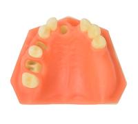 Ultrassist Dental Implant Training Practice Maxillary Model with Sinus, Basic Implant Training Model with Practice Soft Gums, Great Dental Training Tooth for Dental Implant Practice Pink