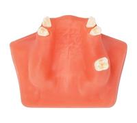 Ultrassist Dental Sinus Lifting & Implant Placement Practice Model B, Basic Implant Training Model with Practice Soft Gums, Great Dental Training Tooth for Dental Implant Practice