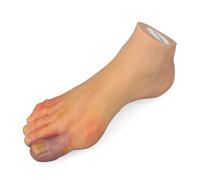 Ultrassist Foot Pathology Model Aid - 6 Visual Details for Clinics
