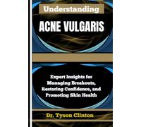 UNDERSTANDING ACNE VULGARIS: Expert Insights for Managing Breakouts, Restoring Confidence, and Promoting Skin Health