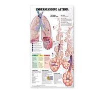 Understanding Asthma Anatomical Chart