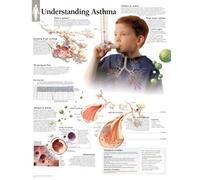 Understanding Asthma Laminated Poster