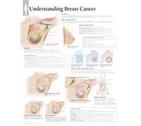Understanding Breast Cancer Paper Poster